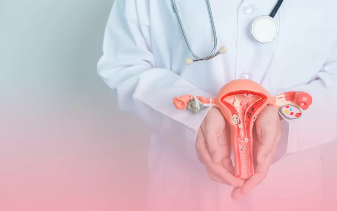 Miomas uterinos: tudo o que você precisa saber